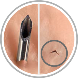 AccuTarg Curved Tip Short Bevel Spinal Needles